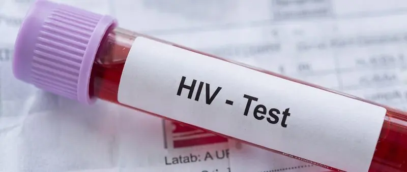 Penyakit kelamin hiv pep prep