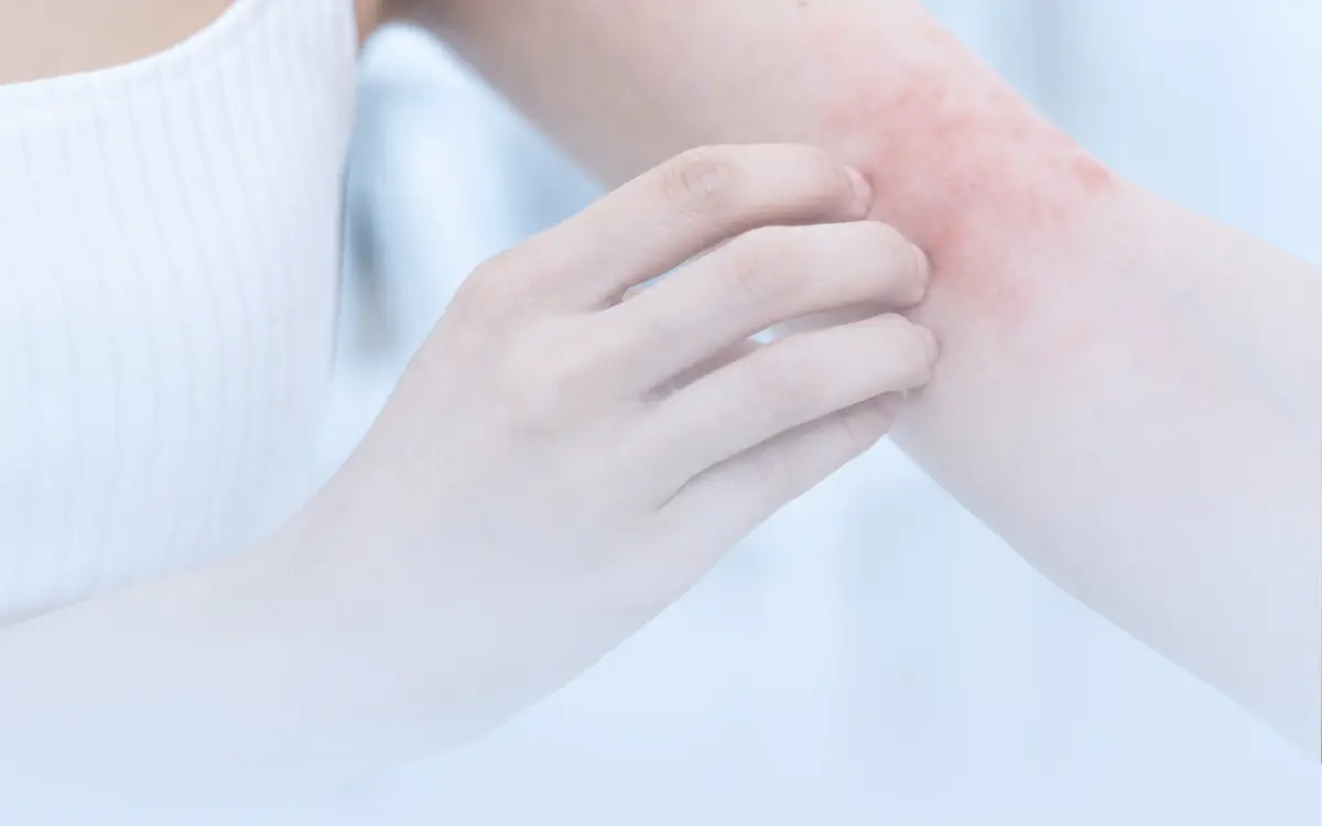 Konsultasikan keluhan Penyakit Kulit | Dokter Spesialis Kulit